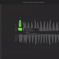 DTX Studio Clinic - implant planning