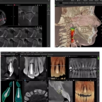 DTX Studio Clinic - anatomical visualization