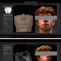 DTX Studio Clinic - facial scanning