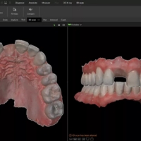 DTX Studio Clinic - virtual teeth