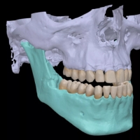 DTX Studio Clinic - 2D AI dental findings