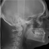 Dexis Orthopantomograph Op 3D LX - Orthodontie