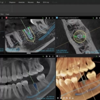 Dexis Orthopantomograph Op 3D LX - Implant