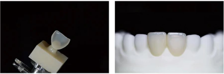 Blocs disilicate de lithium Cameo KrystaFree Aidite translucidité exceptionnelle