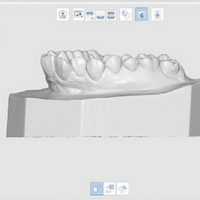 Medit T310 - Scan orthodontique (scan à plat et à la verticale du modèle)