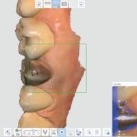 Medit iE - scan des surfaces métalliques