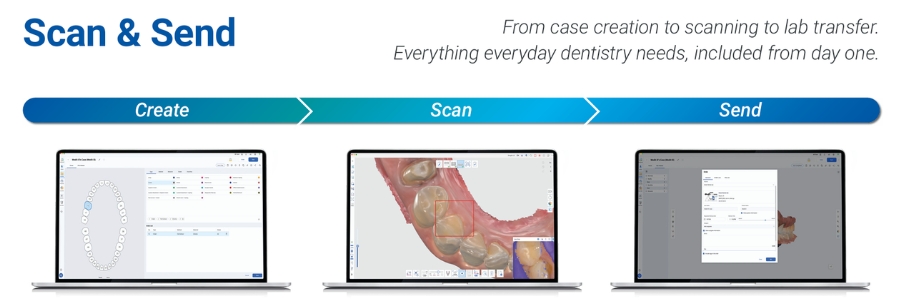 Flux numérique du scanner intra-oral Medit iE