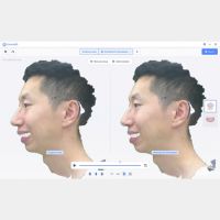 MetiSmile-MR haute fidélité texture