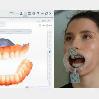 MetiSmile-MR traceurs et marqueurs