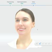 MetiSmile simulation ortho et analyse faciale