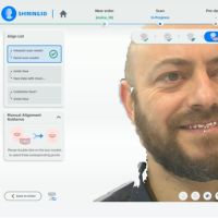 MetiSmile alignement automatique données intra-orales