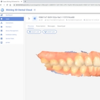 Shining 3D Dental Cloud