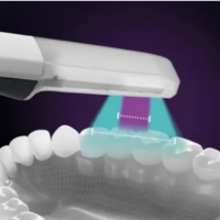 iTero Lumina - Invisalign