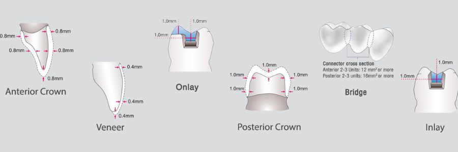 Applications Bloc Zircone KATANA™ STML 12Z 14Z