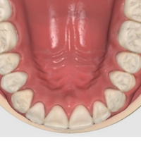Medit i900M - Qualité d’image exceptionnelle avec Glossy Mode